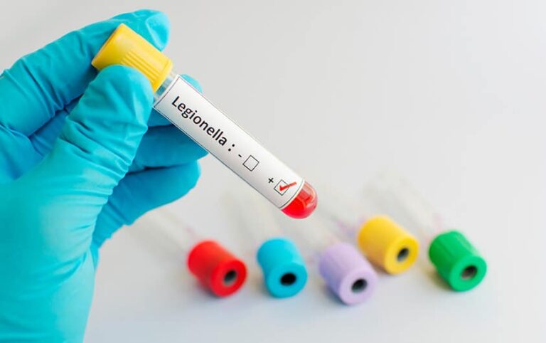 Prevención de legionella en Zaragoza